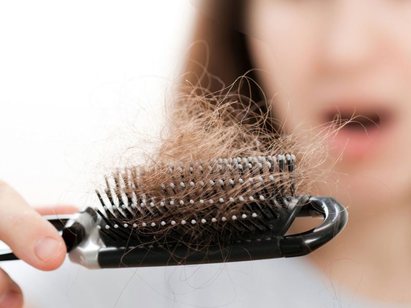علاج مشكلة تساقط الشعر الهرموني لدى السيدات والرجال في أقل وقت