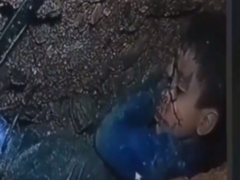 طفل مغربي سقط في بئر