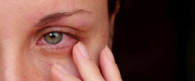 أهم أسباب التهاب العين 