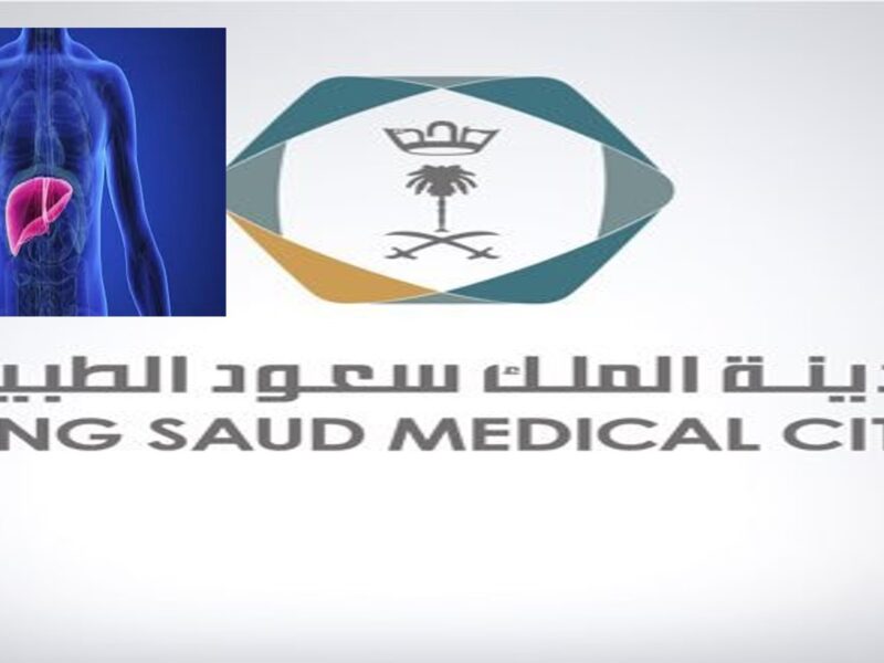 “سعود الطبية” توضح أسباب تليف الكبد وطرق الوقاية منه| تفاصيل